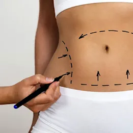 Body toning and firming at our weight loss center in Chennai for effective contouring